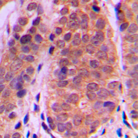 19 - Anti-Histone Deacetylase 5 Antibody AP59786