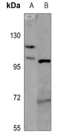 1 - Anti-Histone Deacetylase 5 Antibody AP59786