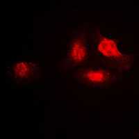 3 - Anti-UBA2 Antibody AP59788