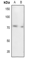 1 - Anti-UBA2 Antibody AP59788