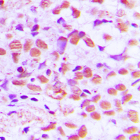 19 - Anti-SAE1 Antibody AP59789