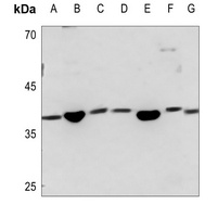 1 - Anti-SAE1 Antibody AP59789