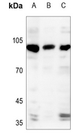 1 - Anti-AASS Antibody AP59791