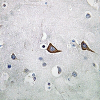 19 - Anti-KCNMB2 Antibody AP59792