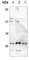 1 - Anti-KCNMB2 Antibody AP59792