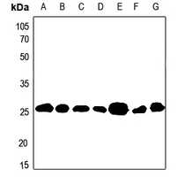 1 - Anti-BCAS2 Antibody AP59793