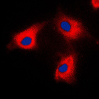 3 - Anti-BCKDK Antibody AP59794