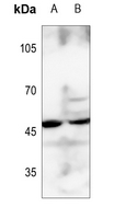 1 - Anti-BCKDK Antibody AP59794