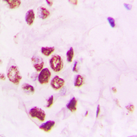 19 - Anti-PIAS3 Antibody AP59797
