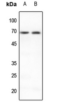 1 - Anti-PIAS3 Antibody AP59797