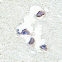 19 - Anti-hnRNP Q Antibody AP59799