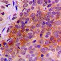 19 - Anti-TXNRD2 Antibody AP59800