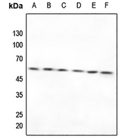 1 - Anti-TXNRD2 Antibody AP59800