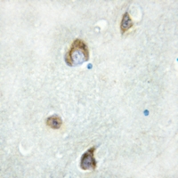 19 - Anti-AHA1 Antibody AP59801