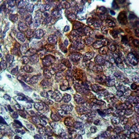 19 - Anti-FGL2 Antibody AP59804