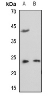 1 - Anti-RAB35 Antibody AP59806