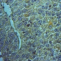19 - Anti-FAIM2 Antibody AP59813
