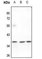 1 - Anti-FAIM2 Antibody AP59813