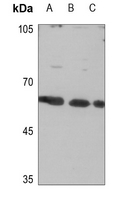 1 - Anti-CLCC1 Antibody AP59815