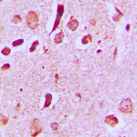 19 - Anti-JIP3 Antibody AP59816