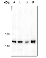 1 - Anti-JIP3 Antibody AP59816
