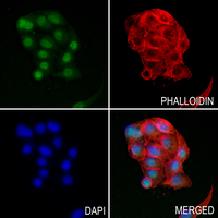 3 - Anti-PIP5K1C Antibody AP59817