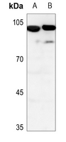 1 - Anti-PIP5K1C Antibody AP59817