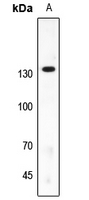 1 - Anti-SAP130 Antibody AP59818