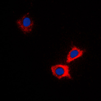 3 - Anti-ABCB10 Antibody AP59819