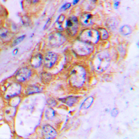 19 - Anti-ABCB10 Antibody AP59819