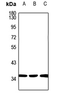 1 - Anti-Carbonic Anhydrase 14 Antibody AP59820