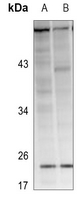 1 - Anti-RAB38 Antibody AP59821