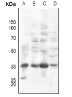 1 - Anti-PI-TP beta Antibody AP59822