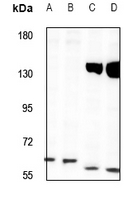 1 - Anti-TOR1AIP1 Antibody AP59826