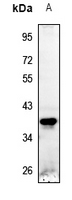 1 - Anti-STEAP1 Antibody AP59828