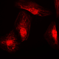 3 - Anti-RANBP6 Antibody AP59829