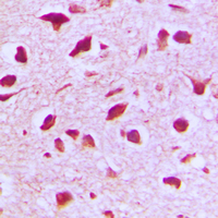 19 - Anti-RANBP6 Antibody AP59829