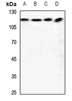 1 - Anti-RANBP6 Antibody AP59829