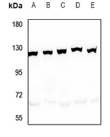 1 - Anti-SND1 Antibody AP59830