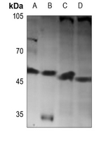 1 - Anti-BMP10 Antibody AP59832