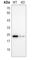 0 - Anti-UBE2T Antibody [KO/KD Validated] AP59833