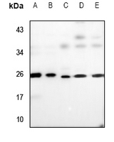 1 - Anti-UBE2T Antibody [KO/KD Validated] AP59833