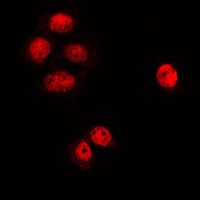 3 - Anti-MGCRACGAP Antibody AP59834