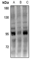 1 - Anti-UHRF1 Antibody AP59835