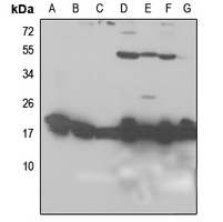 1 - Anti-RPL26L1 Antibody AP59838