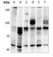1 - Anti-Cytochrome P450 39A1 Antibody AP59839