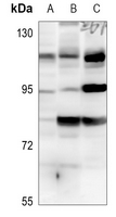 1 - Anti-Histone Deacetylase 7 Antibody AP59842
