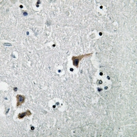 19 - Anti-ATP6V1H Antibody AP59843