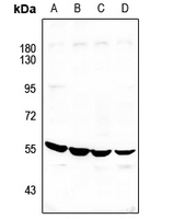 1 - Anti-ATP6V1H Antibody AP59843