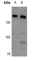 1 - Anti-ARID4B Antibody AP59845